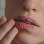 dry mouth and lips